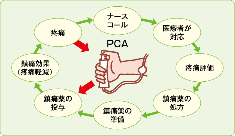 図1　従来の鎮痛法とPCAによる鎮痛法のプロセスの違い