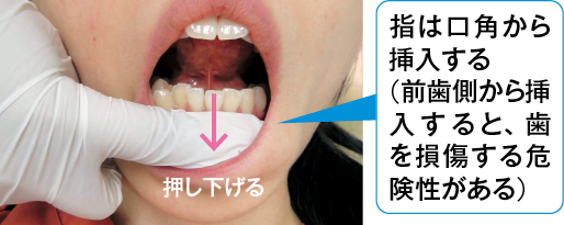 指は口角から