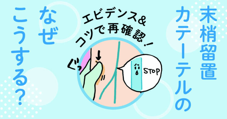末梢留置カテーテルサムネイル