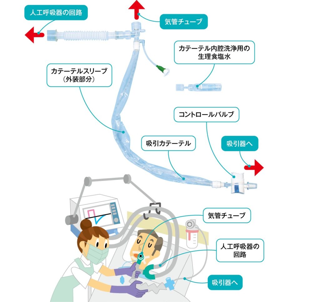 エコキャス