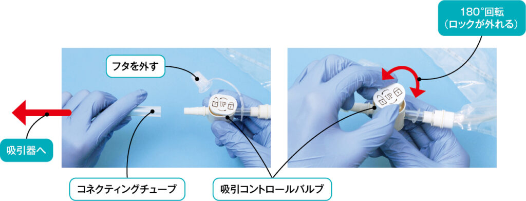 コネクティングチューブを吸引コントロールバルブに接続し、バルブを180 °回転させる