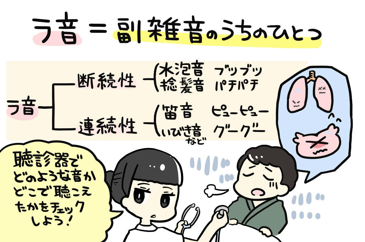 ラ音2