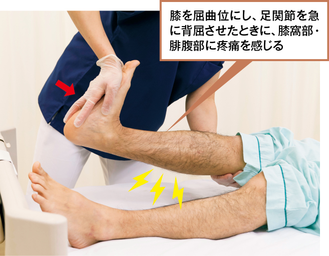ホーマンズ徴候