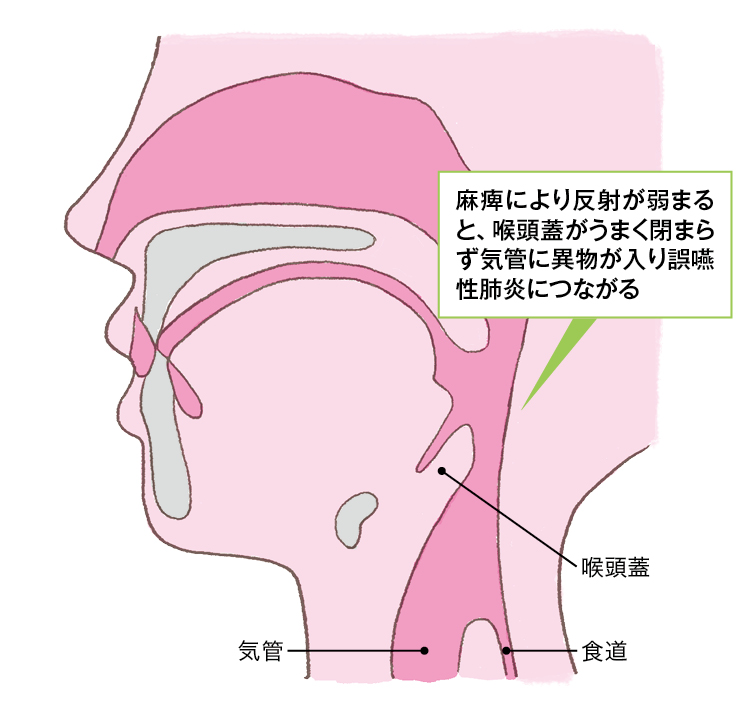 喉頭蓋の位置関係