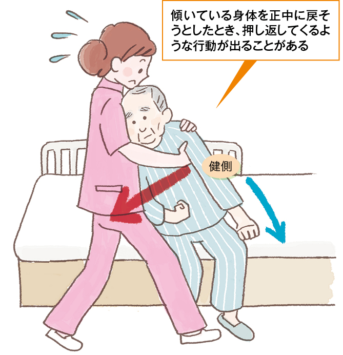 プッシャー症状の患者さん