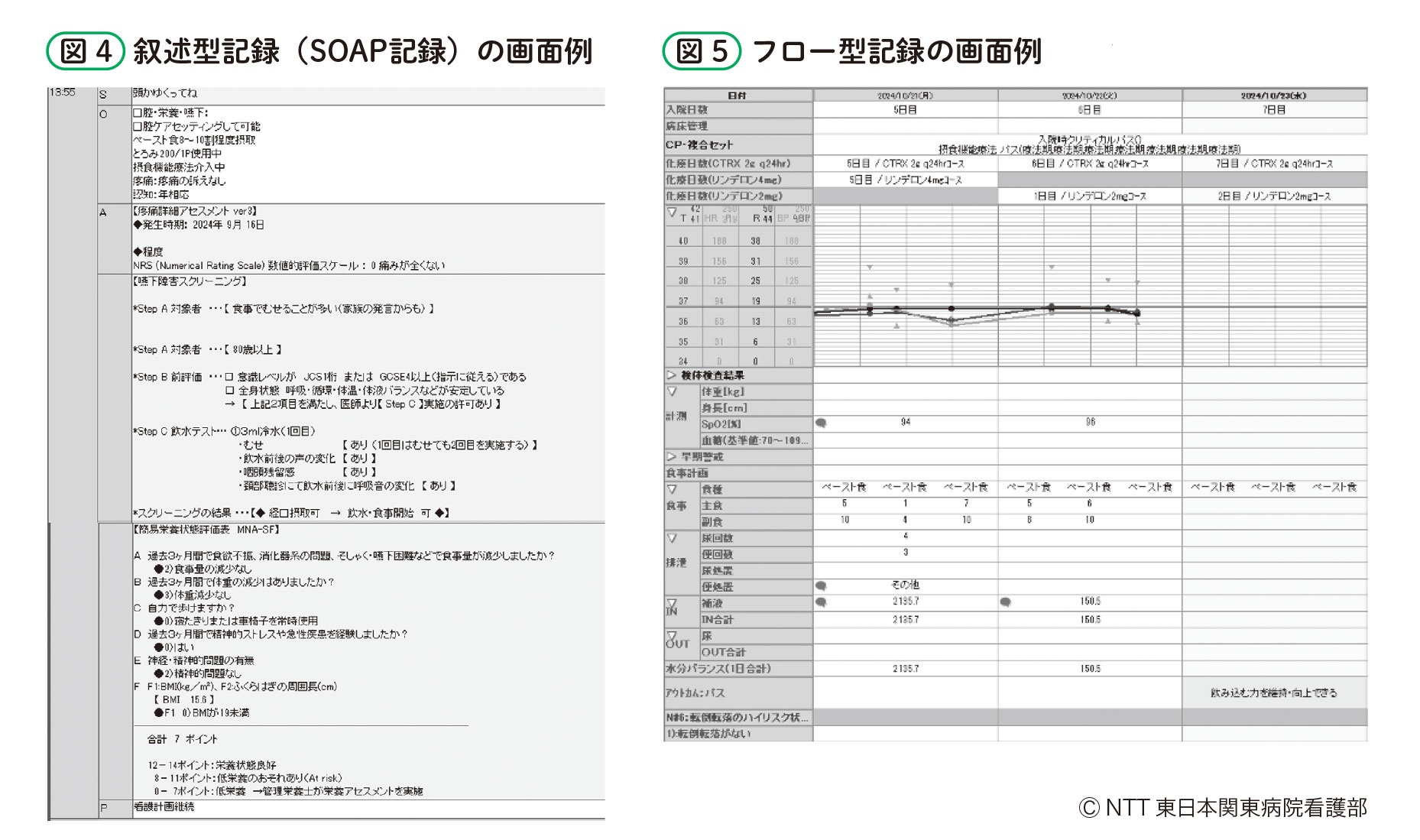 叙述型記録とフロー型記録