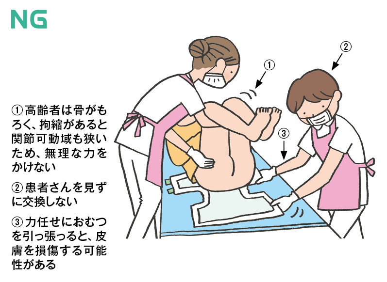 股関節に拘縮がある患者さん、どうおむつ交換する?