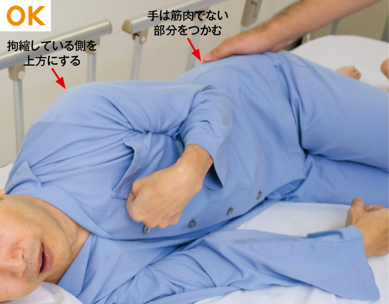 拘縮のある患者さんの支え方