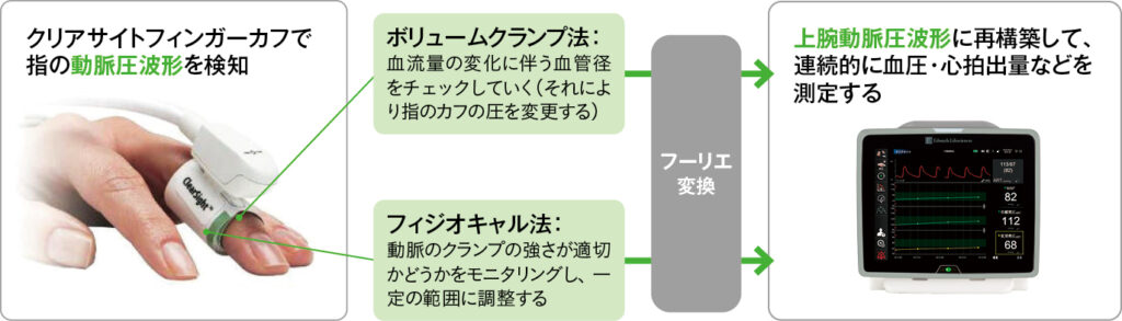 血行動態モニタリング装置