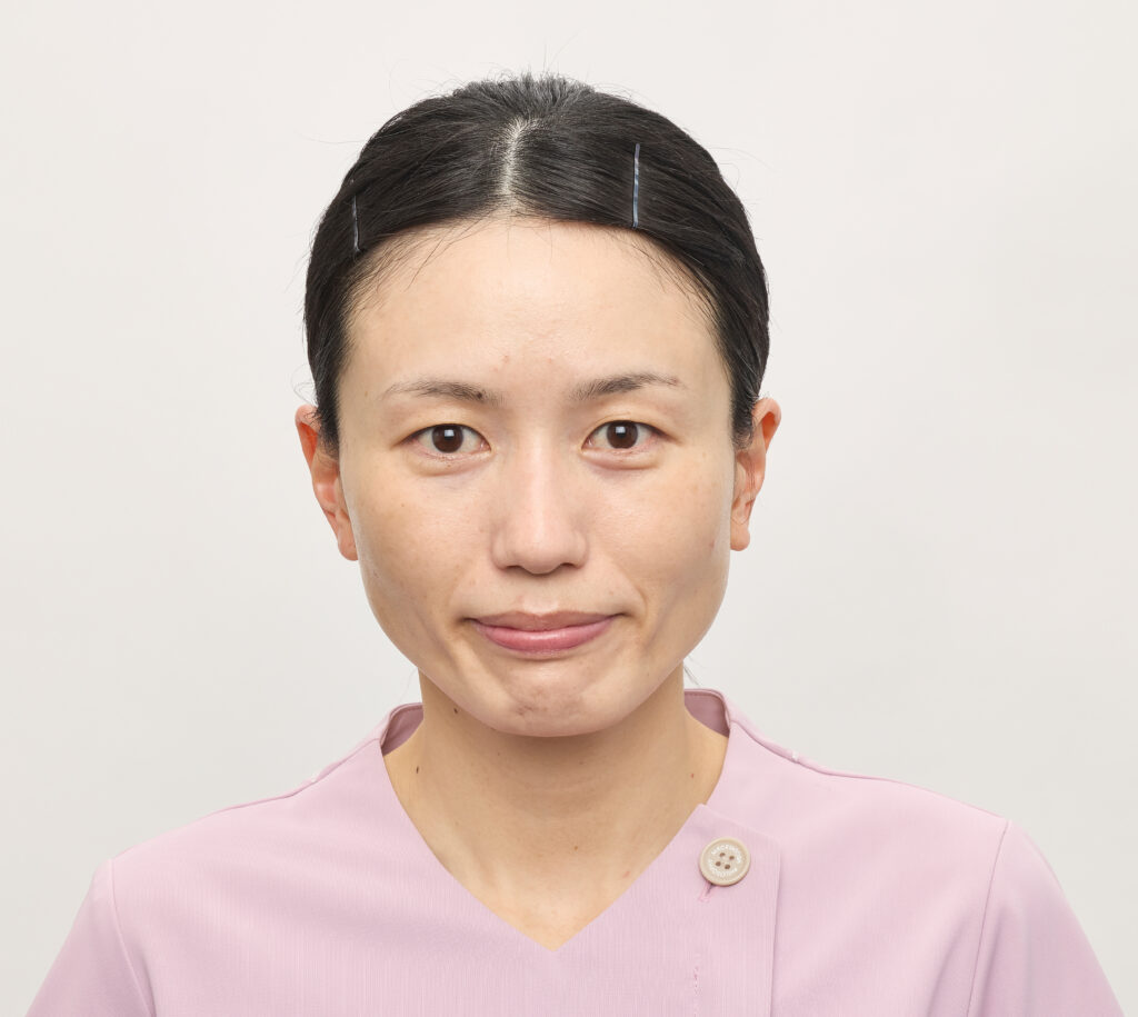 シミ＆シワbefore