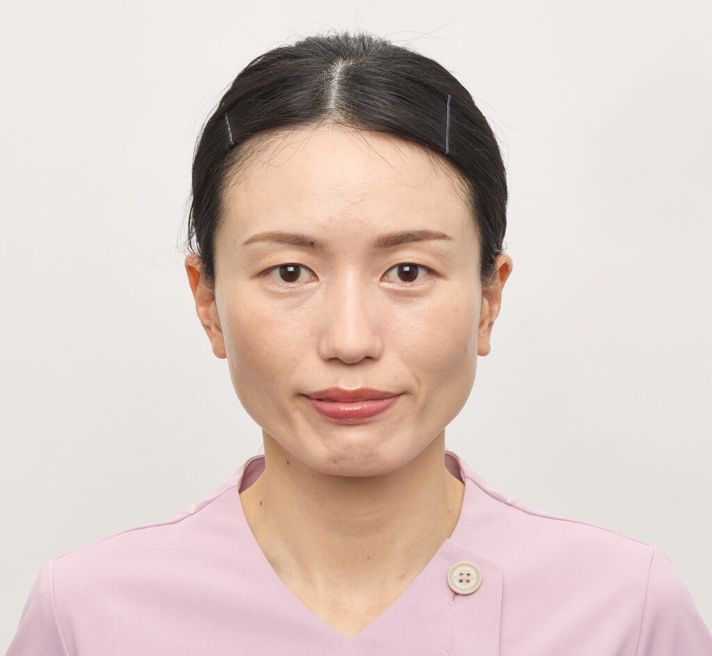 シミ＆シワ_after