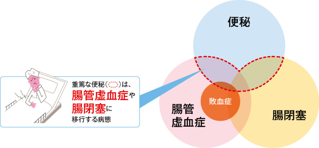 重篤な便秘の定義の図