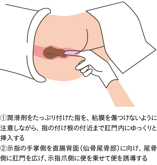 摘便のイラスト