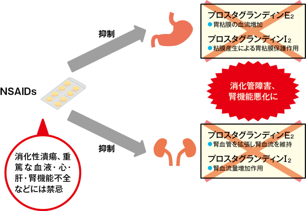 NSAIDs の副作用