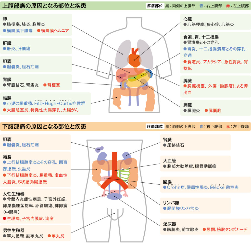 疼痛の部位と原因疾患
