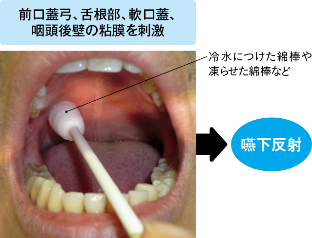 アイスマッサージ(間接訓練)の様子