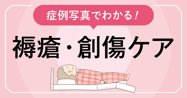 褥瘡・総省ケアサムネイル