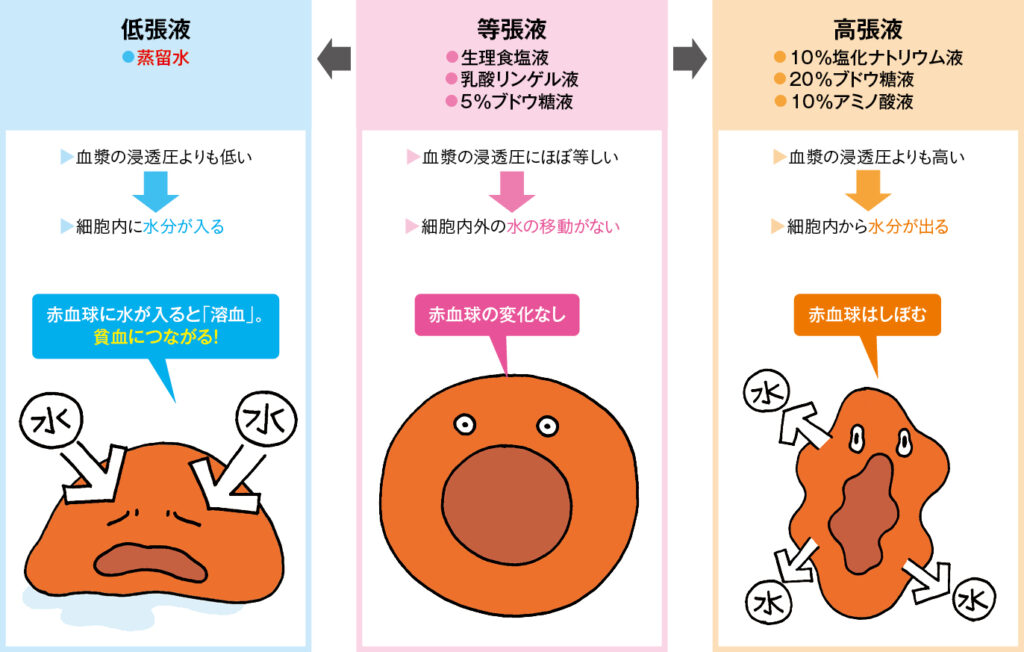 輸液における等張液・高張液・低張液の違い