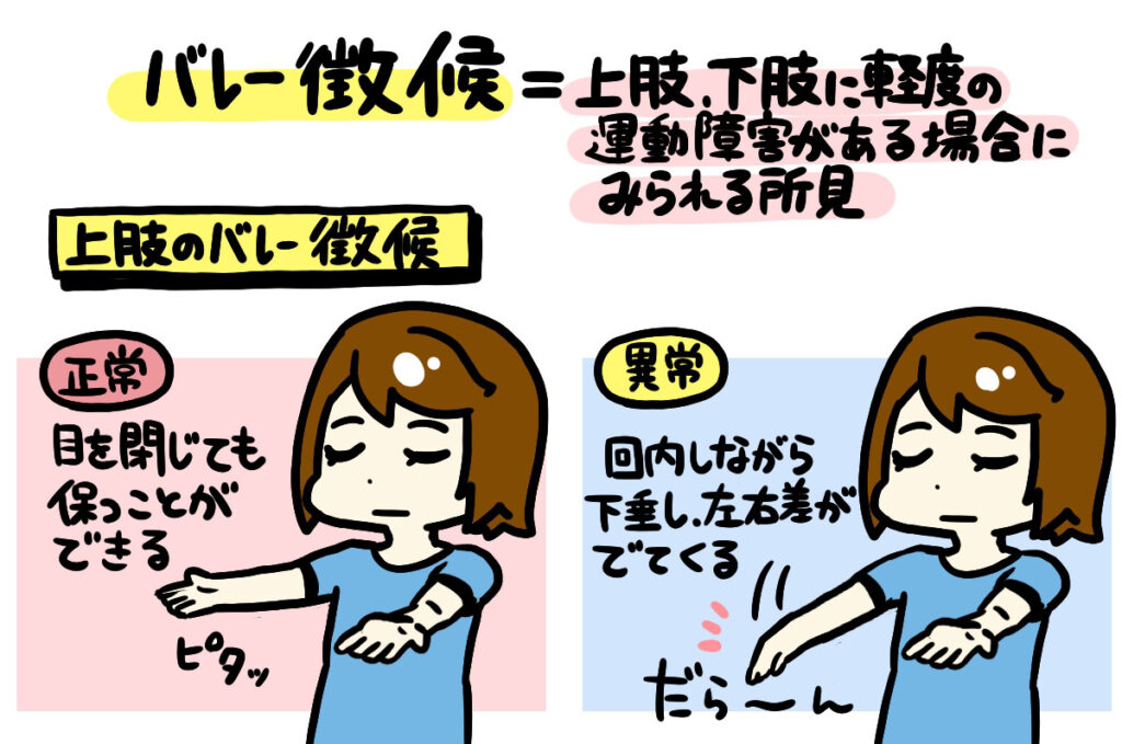 バレー徴候イラスト2