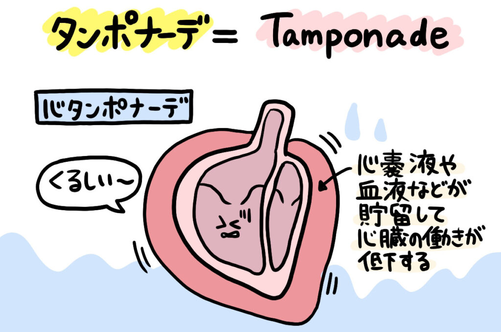 タンポナーデイラスト2