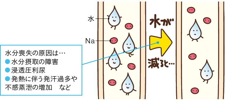 体内から水分のみが喪失、相対的にNaの量が増える