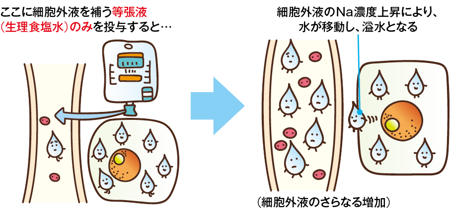 脱水の種類によって投与される輸液(Na欠乏性脱水の場合)