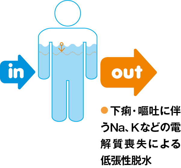 下痢・嘔吐での低調性脱水の状態