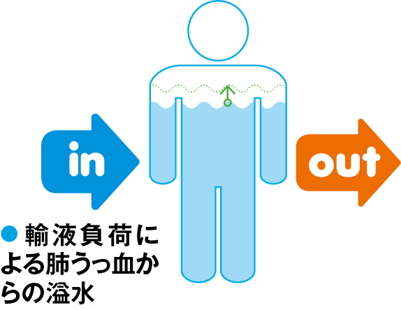 輸液負荷による溢水の状態