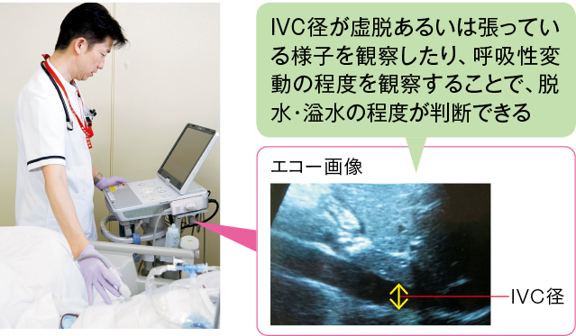 超音波画像診断装置(エコー)を用いた計測により脱水・溢水の程度をアセスメント
