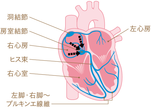洞性頻脈の心臓イラスト
