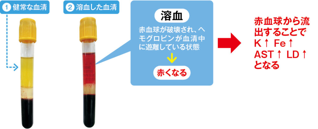 溶血・凝血が生化学検査に与える影響
