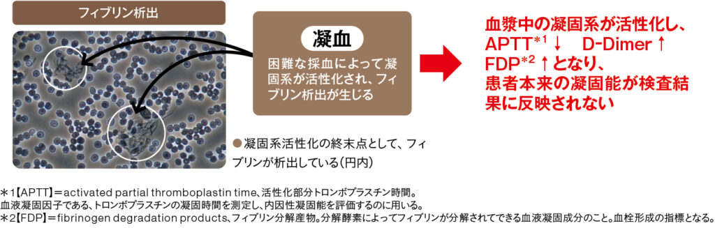 溶血・凝血が凝固検査に与える影響