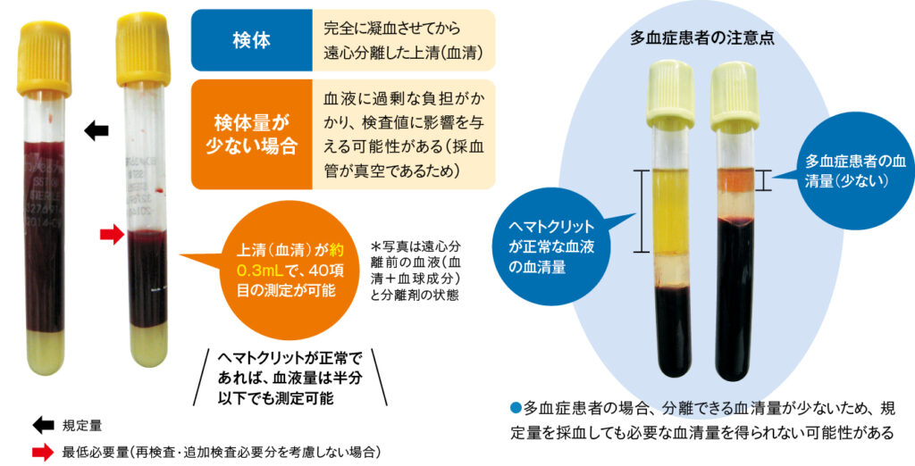 生化学検査における“必要最低限”の検体量