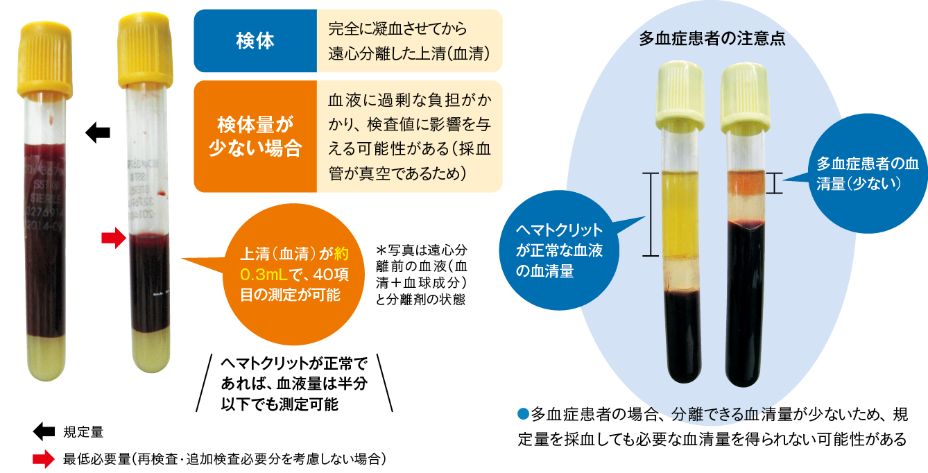 生化学検査における“必要最低限”の検体量