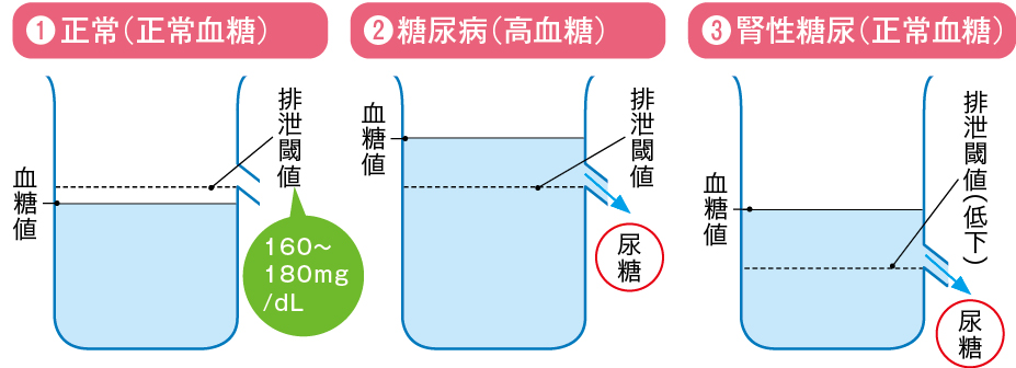 尿糖出現のメカニズム