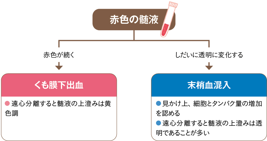 「末梢血」と「くも膜下出血」の特徴と見分け方のポイント