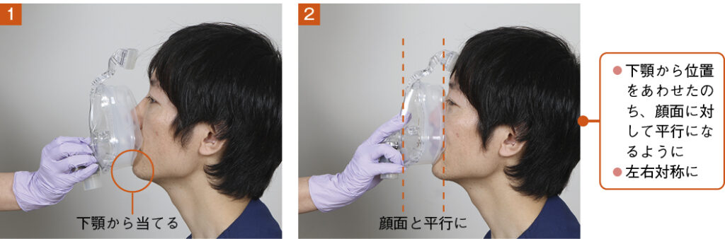 マスクフィッティングの手順①下顎から合わせる