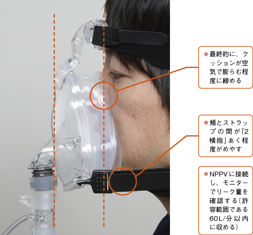 マスクフィッティングの手順②②ストラップをゆるめに装着し、徐々に締めていく