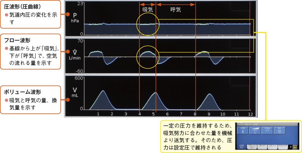 CPAPモードのグラフィックモニターの例