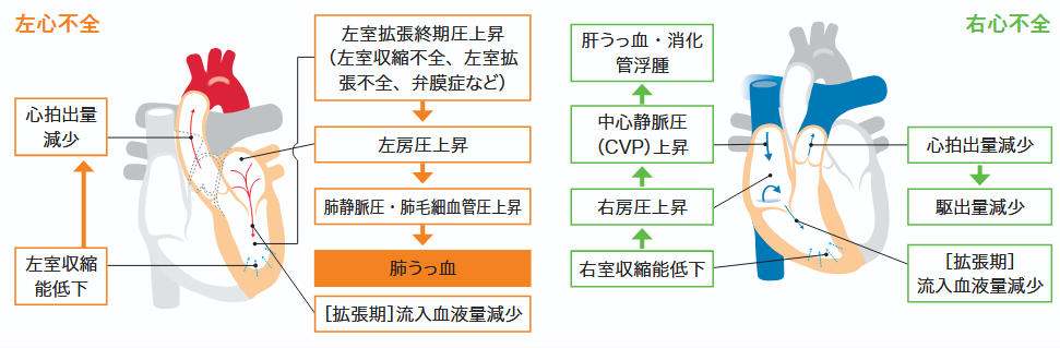 左心不全と右心不全の病態の図