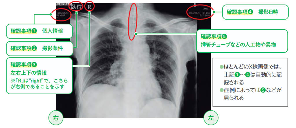 胸部X線画像の基本情報の図