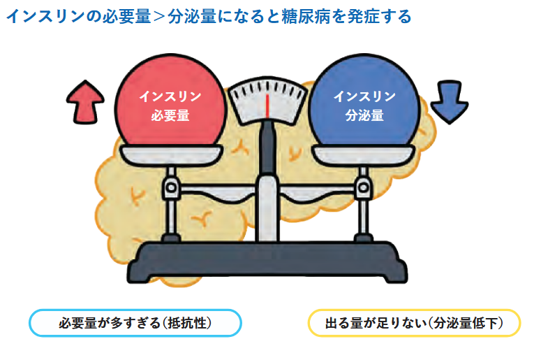 インスリンの必要量と分泌量