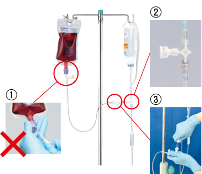 プライミングセットを用いて側管から抗がん薬を投与するためのメインルートの画像