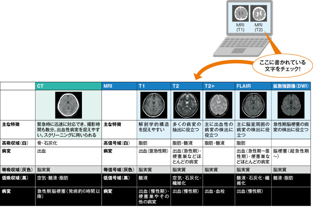 CT・MRI画像の違いの表