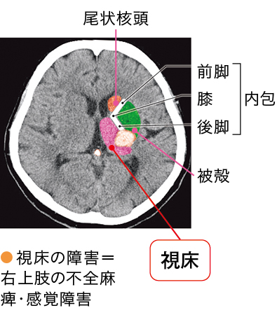 画像で関連する脳機能を確認する