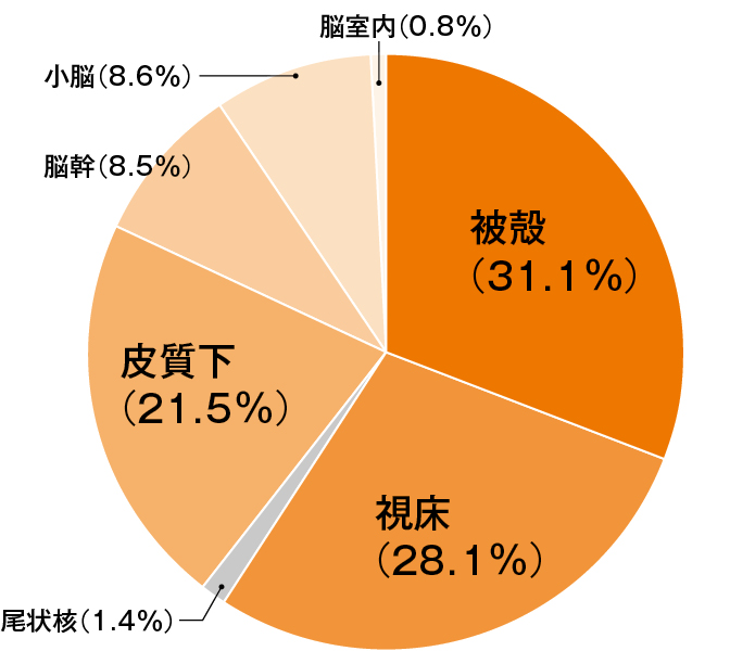 脳出血の部位別頻度を示す円グラフ