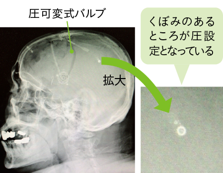 圧可変式バルブが付いた東部の画像