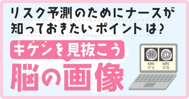 脳の画像サムネイル