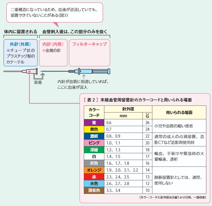 留置針の構造の解説図