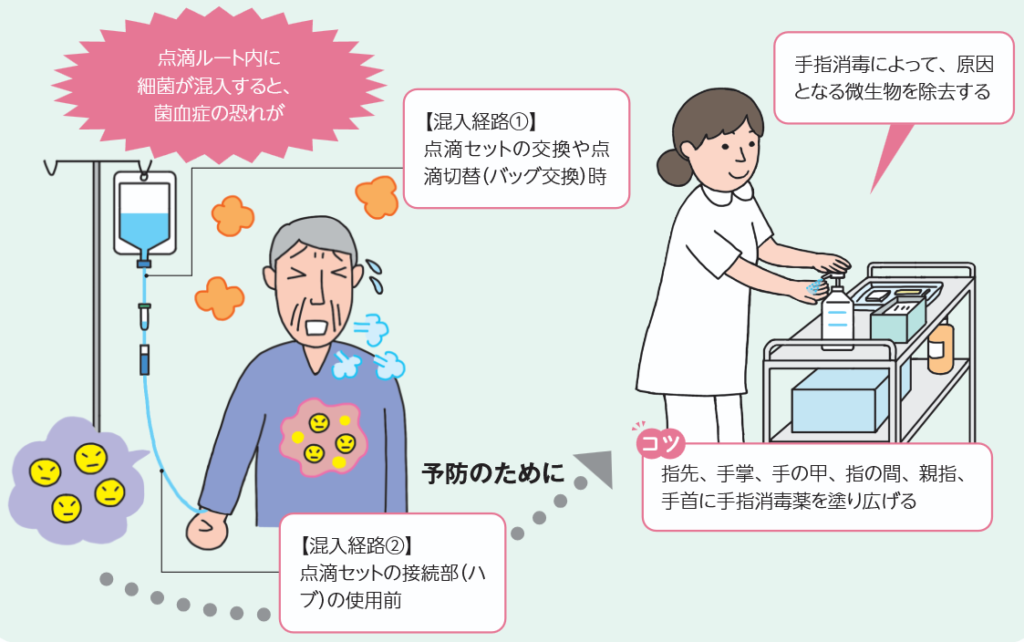 点滴ルートを介した感染と手指消毒による予防
